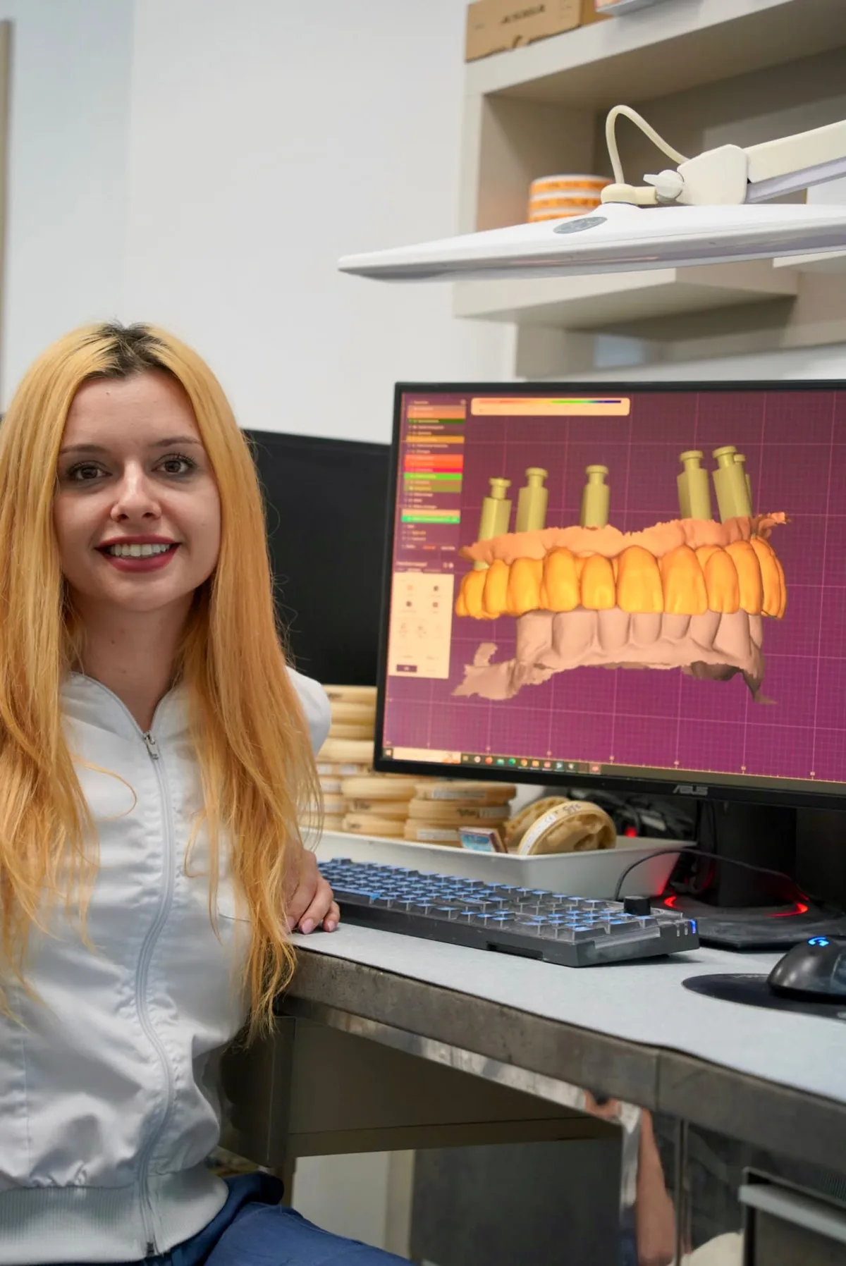 Scanare digitală și proiectare dentară în laboratorul Alkaterra Dental Pitești